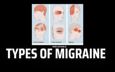 Understanding Types of Migraine