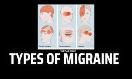 Understanding Types of Migraine