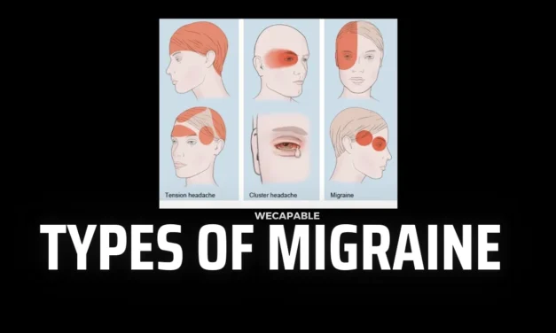 Understanding Types of Migraine